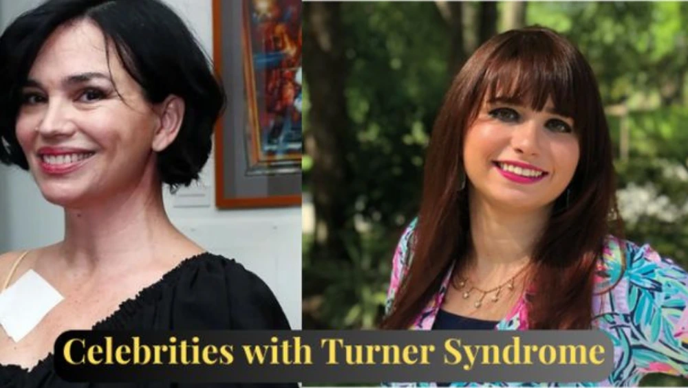 Collage of inspiring public figures and symbolic imagery representing celebrities with Turner Syndrome, promoting awareness and advocacy for the condition.