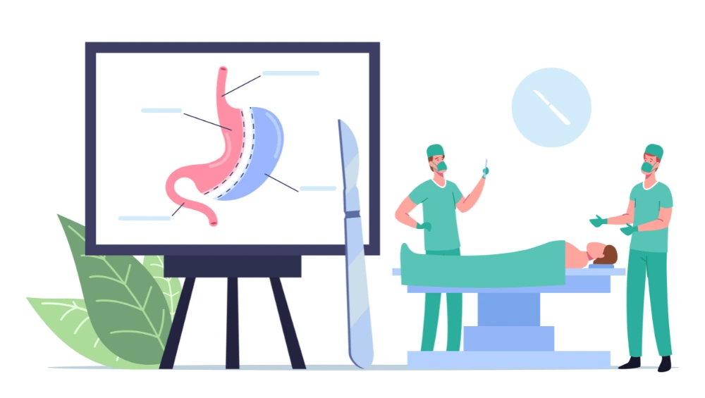 Medical illustration showing gastroshiza condition with intestines outside abdominal wall and surgical treatment options